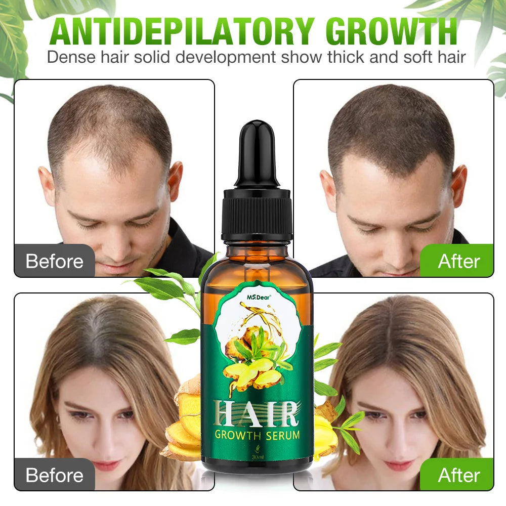 Spark Lift Hair Growth Stimulator Brush
