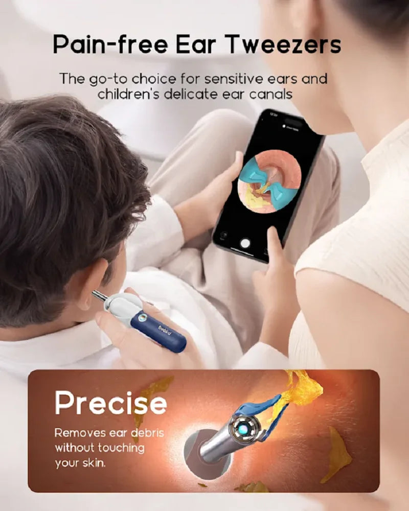 Smart Ear Wax Remover – 1080p Camera for Safe Cleaning